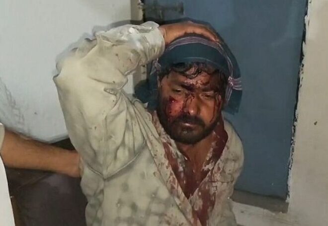 धारदार हथियारों से युवक पर जान लेवा हमला