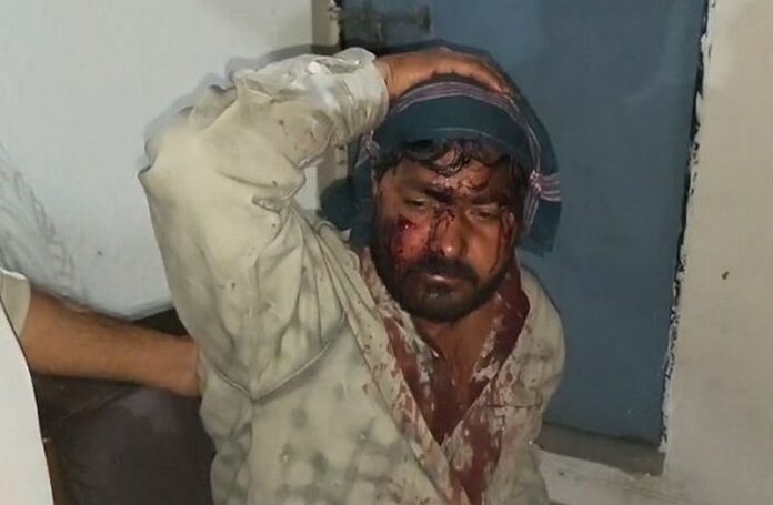 धारदार हथियारों से युवक पर जान लेवा हमला